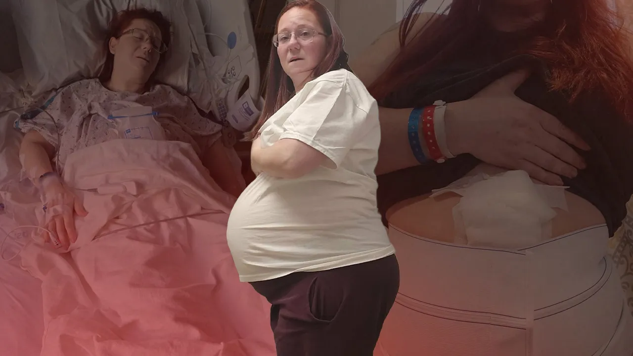 Doktorlar üç yıl boyunca “Kilo ver” dedi, görenler hamile sandı! Gerçek çok başka çıktı