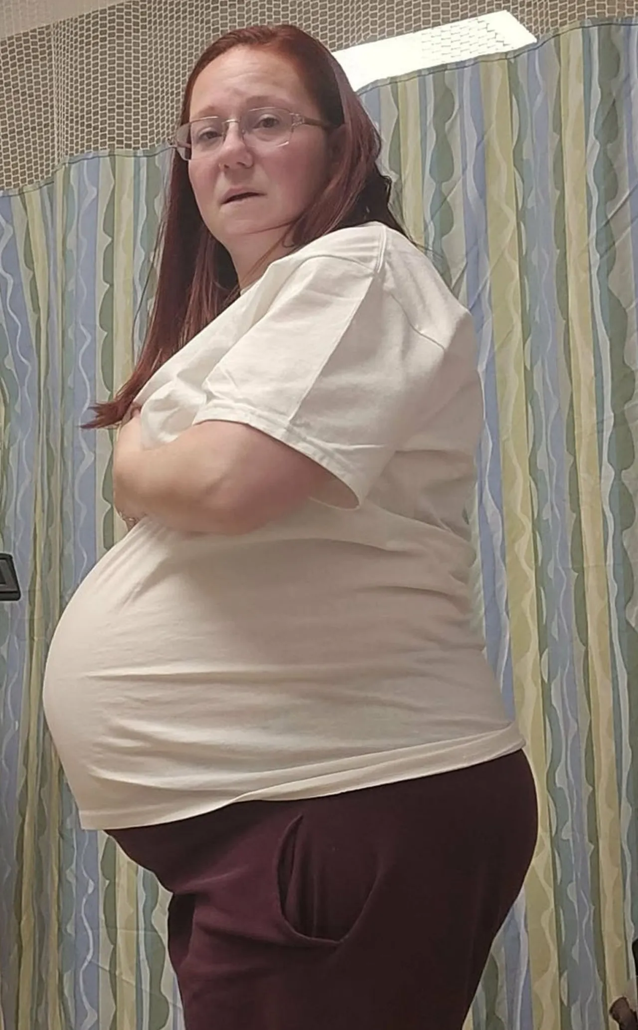 Doktorlar üç yıl boyunca “Kilo ver” dedi, görenler hamile sandı! Gerçek çok başka çıktı