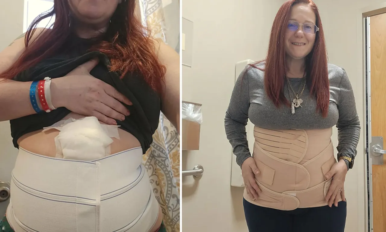 Doktorlar üç yıl boyunca “Kilo ver” dedi, görenler hamile sandı! Gerçek çok başka çıktı