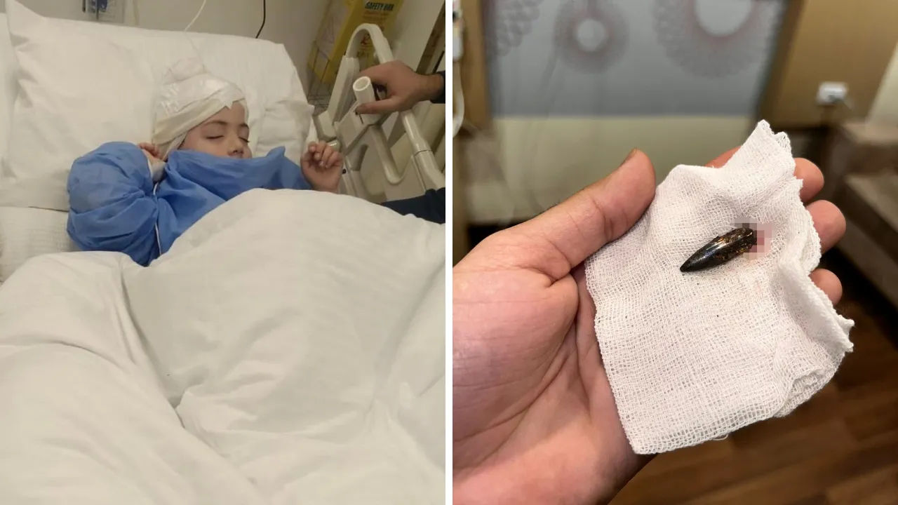 Gazzeli Awad 1,5 yıldır başına isabet eden mermiyle yaşıyordu: Türk yardımseverler yardımına koştu