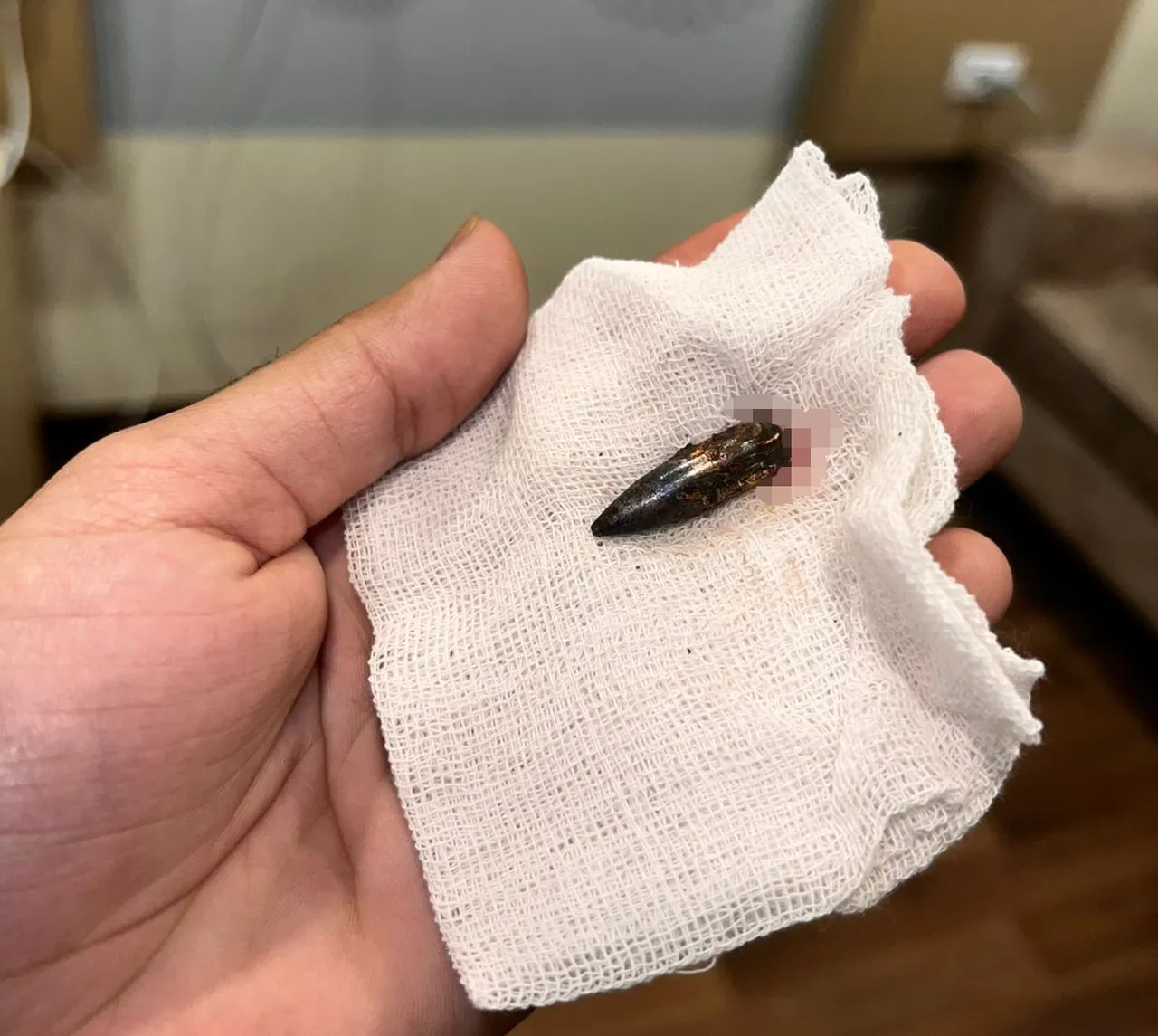 Gazzeli Awad 1,5 yıldır vücuduna isabet eden mermiyle yaşıyordu: Türk yardımseverler yardımına koştu