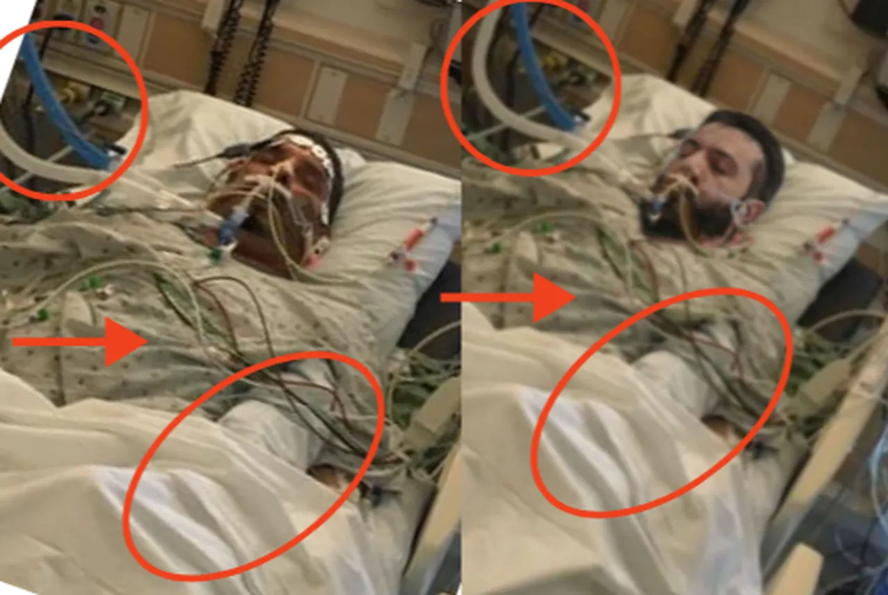 Şaranın suikaste uğradığı iddiaları gündem olmuştu! Hastanedeki fotoğrafı montaj çıktı