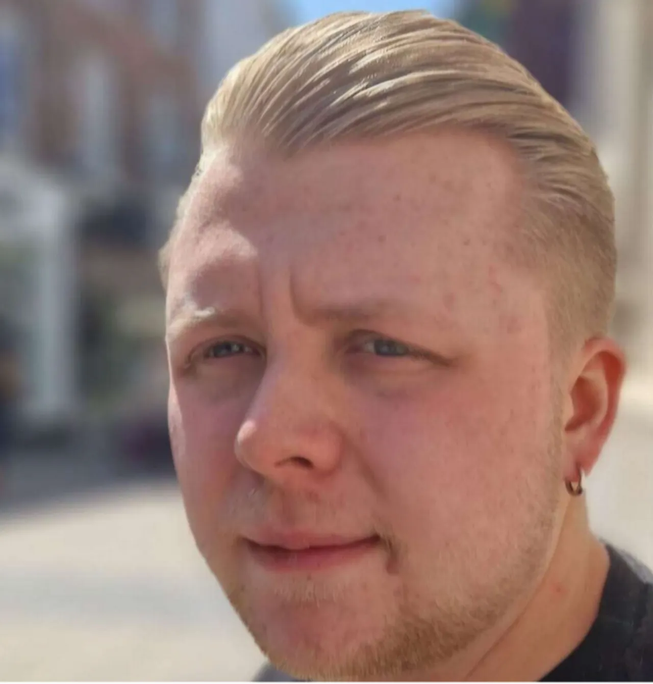 Bu yaşta olur mu demeyin! 24 yaşında demans teşhisi konuldu