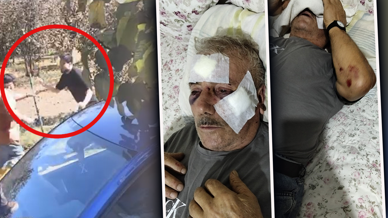 Kemikleri kırıldı, işitme kaybı yaşadı, yüzünde 9 dikiş var! Öğretmenden 68 yaşındaki komşusuna muştalı saldırı  görseli