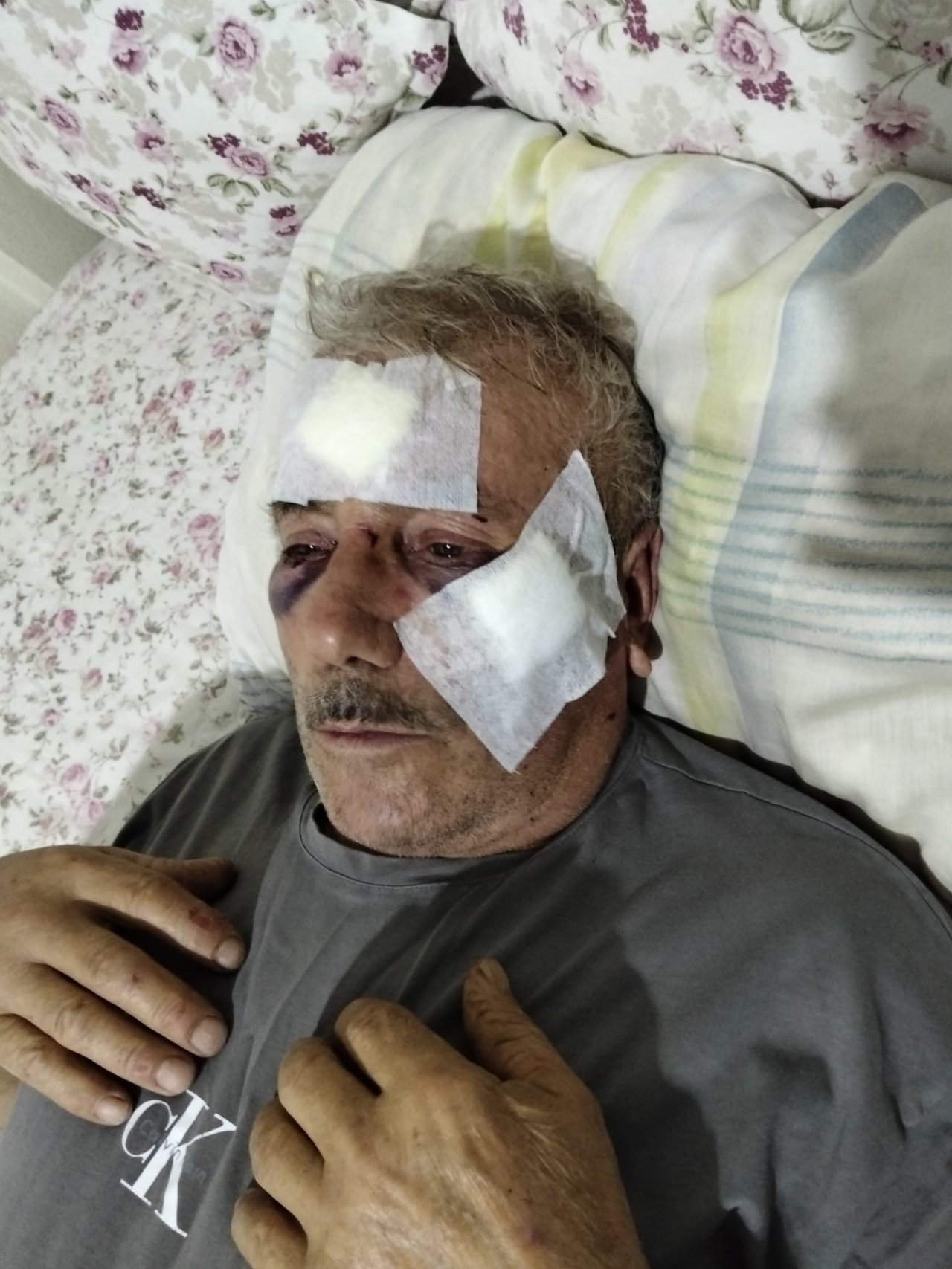 Kemikleri kırıldı, işitme kaybı yaşadı, yüzünde 9 dikiş var! Öğretmenden 68 yaşındaki komşusuna muştalı saldırı