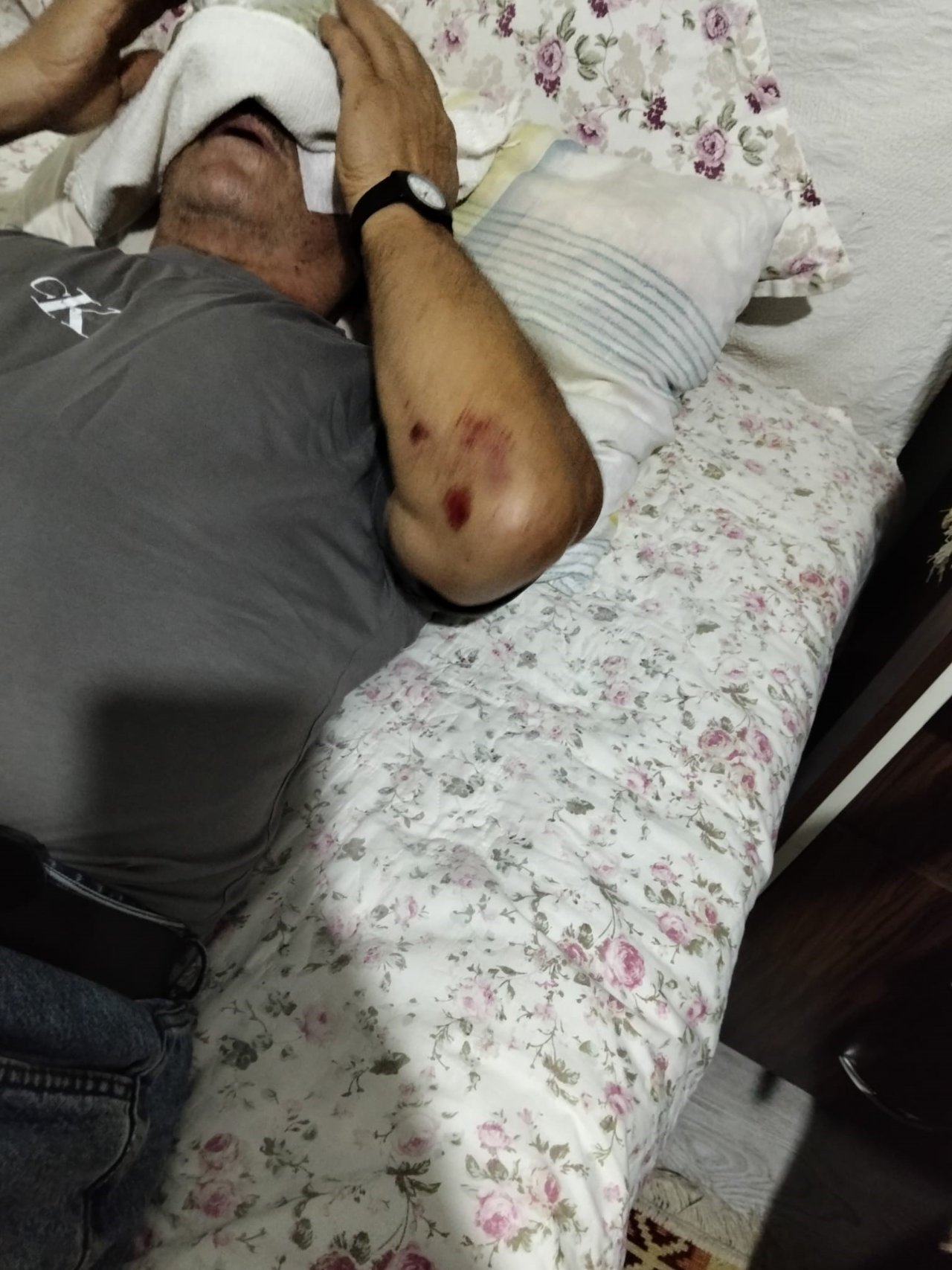 Kemikleri kırıldı, işitme kaybı yaşadı, yüzünde 9 dikiş var! Öğretmenden 68 yaşındaki komşusuna muştalı saldırı
