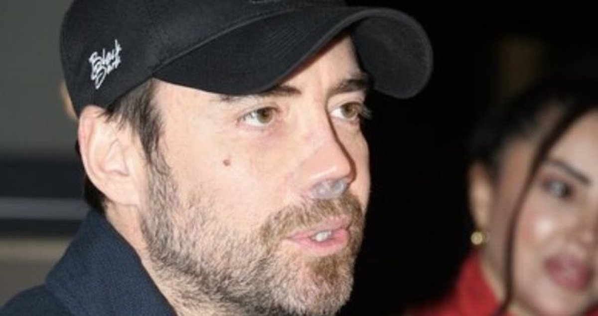 13 defa ameliyat masasına yattı! Murat Dalkılıç'ın son hali dikkat çekti