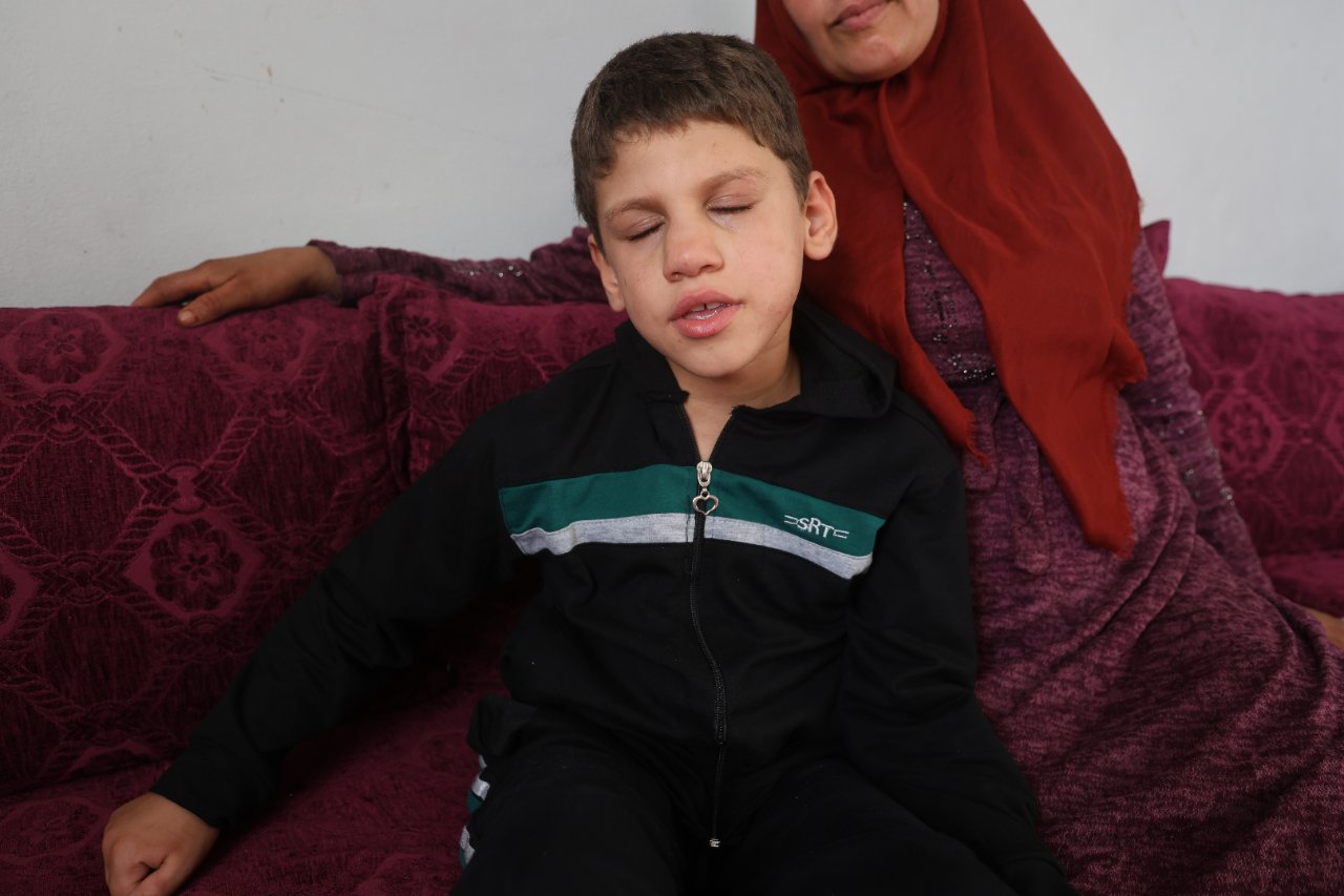 8 yıl dünyayı bulanık gördü, şimdi bir umudu var! Küçük Ömer ameliyat oldu: En çok annemi görmek istiyorum