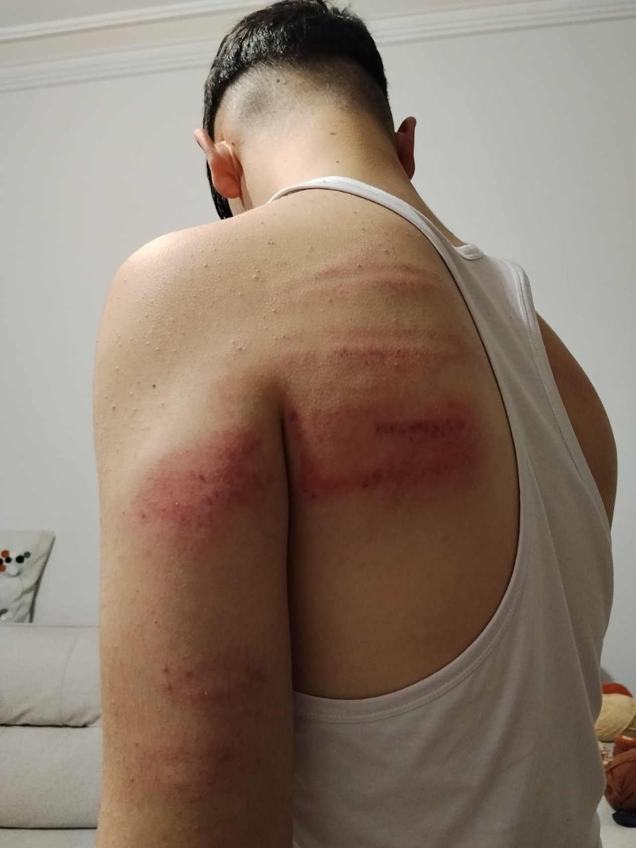Süpürge sapını üzerinde kırdı! Sırtı mosmor, kafasında şişlik var, dudağı patlak… 15 yaşındaki çırağa kan donduran işkence iddiası