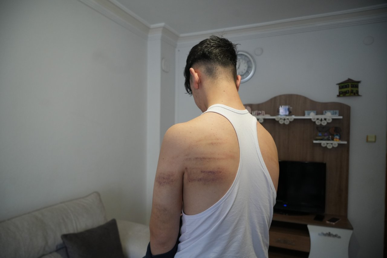 Süpürge sapını üzerinde kırdı! Sırtı mosmor, kafasında şişlik var, dudağı patlak… 15 yaşındaki çırağa kan donduran işkence iddiası