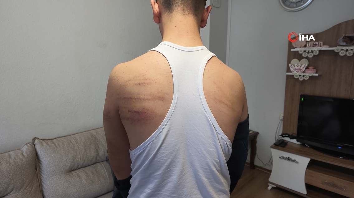 Süpürge sapını üzerinde kırdı! Sırtı mosmor, kafasında şişlik var, dudağı patlak… 15 yaşındaki çırağa kan donduran işkence iddiası