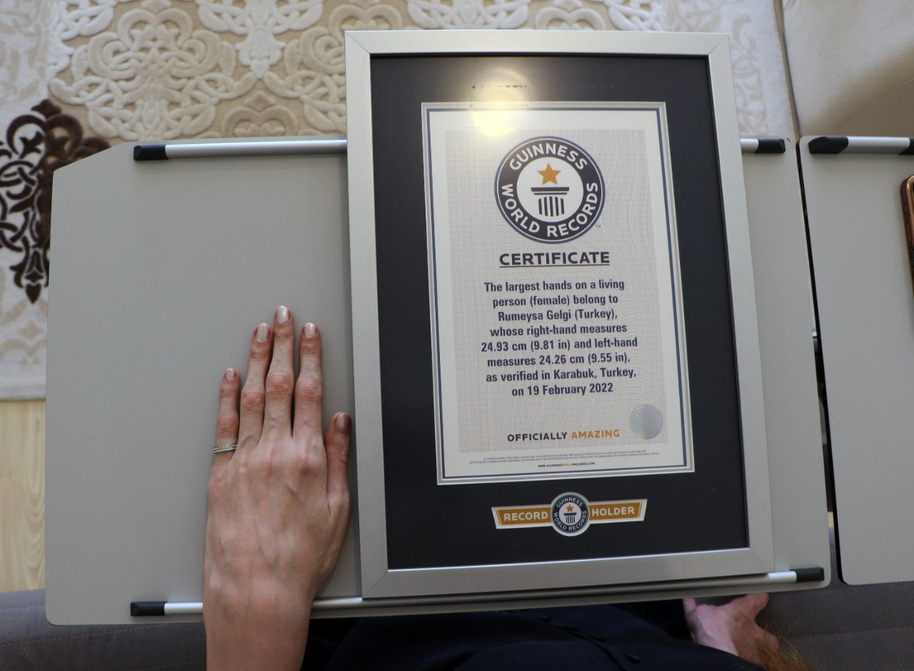 12 yılda 8 dünya rekoru! Dünyanın en uzun boylu kadını yine Guinness Rekorlar Kitabı'nda, hastalığının ismi değişti