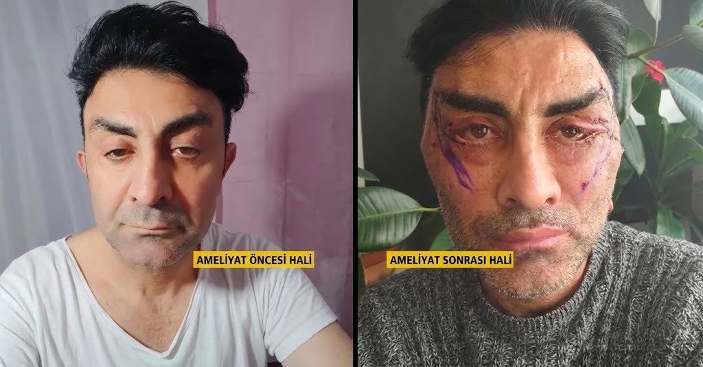 Evlilik hayaliyle gitti, tanınmayacak hale geldi! 248 bin lirasından olan adam bantsız uyuyamıyor