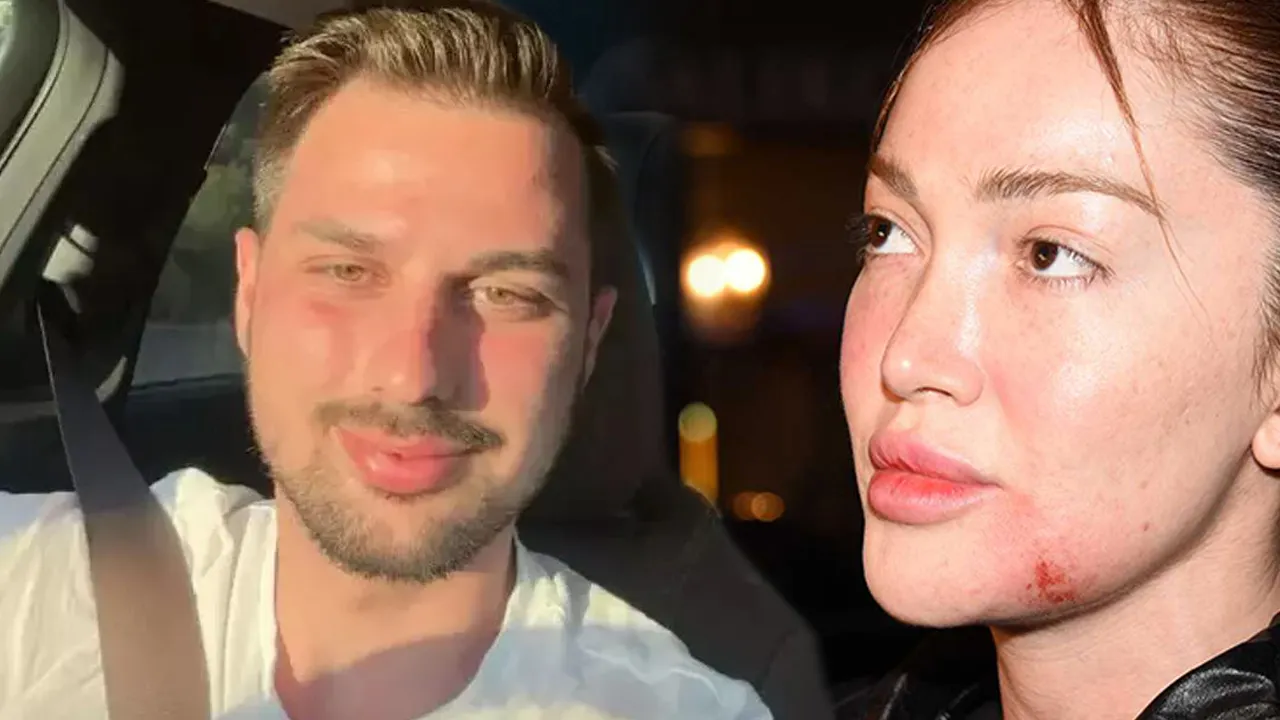 Fenomen Danla Bilic’e yumruk atan Berk Çetin’in cezası belli oldu