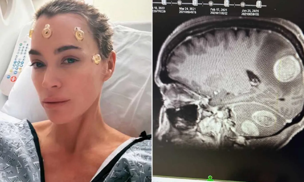 Migren diye gitti, acil ameliyata alındı! Umutların tükendiği yerde beklenmedik sonuç