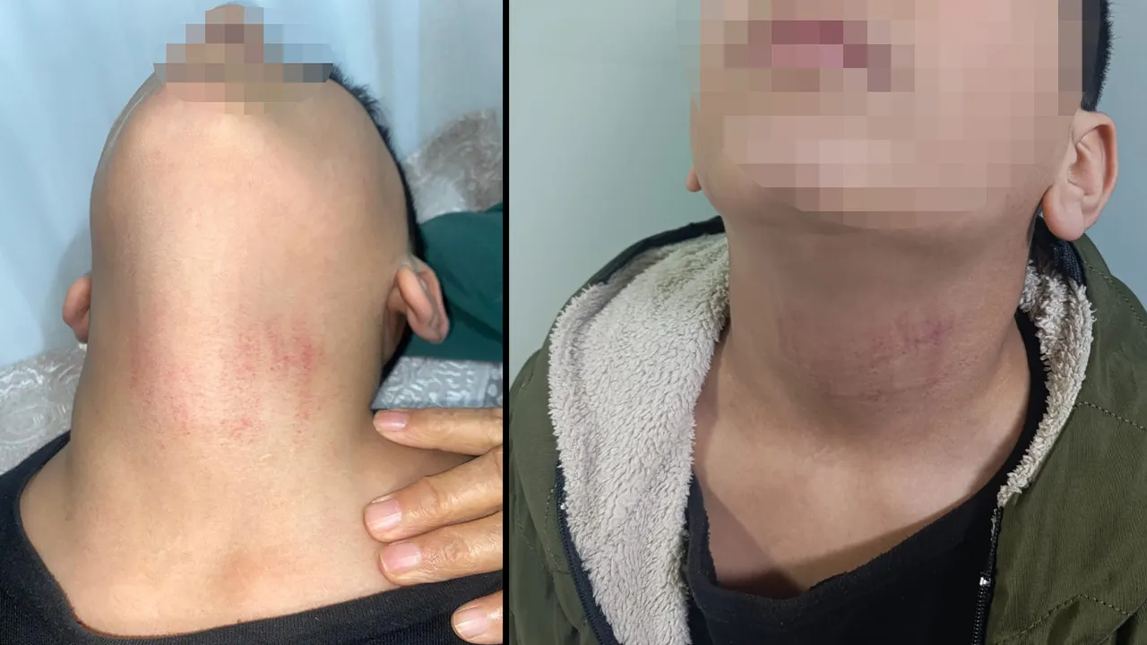 Kadın memurdan ortaokul öğrencisine darp! Şiddetin nedeni 'bayrak' çıktı 