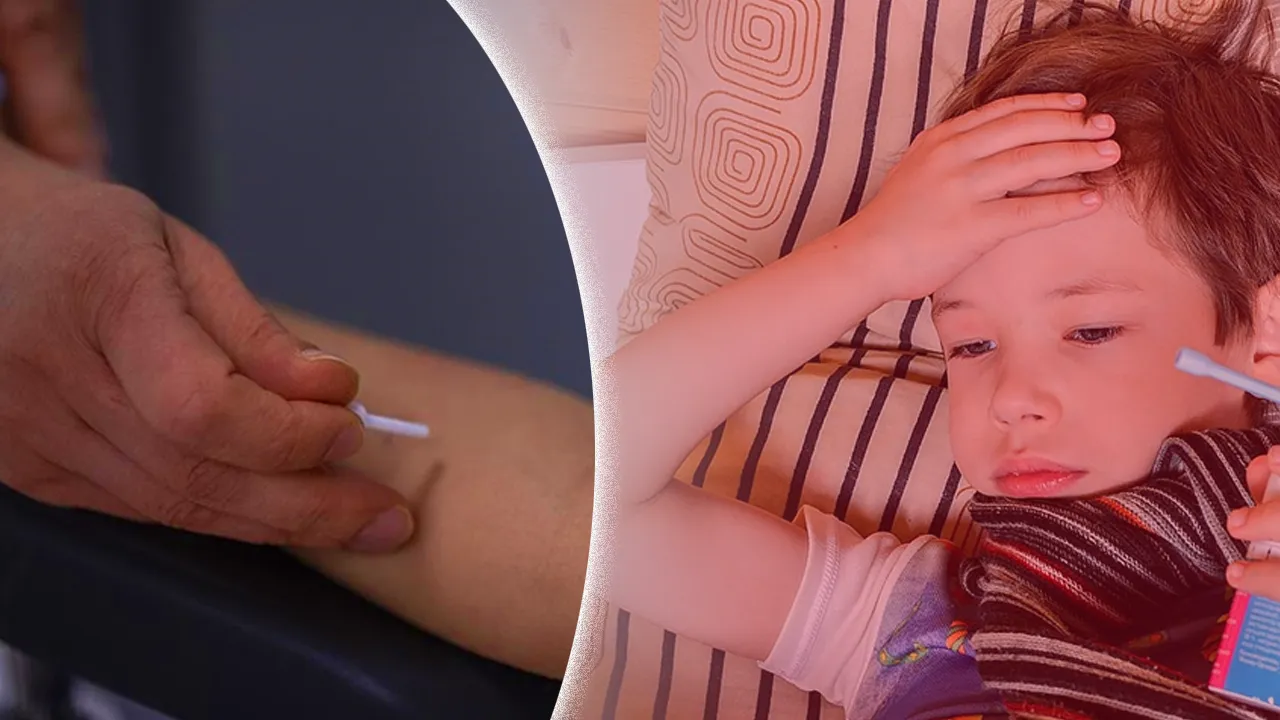 Her 20 çocuktan birinde görülüyor! İşte alerji riski olan 4 gıda