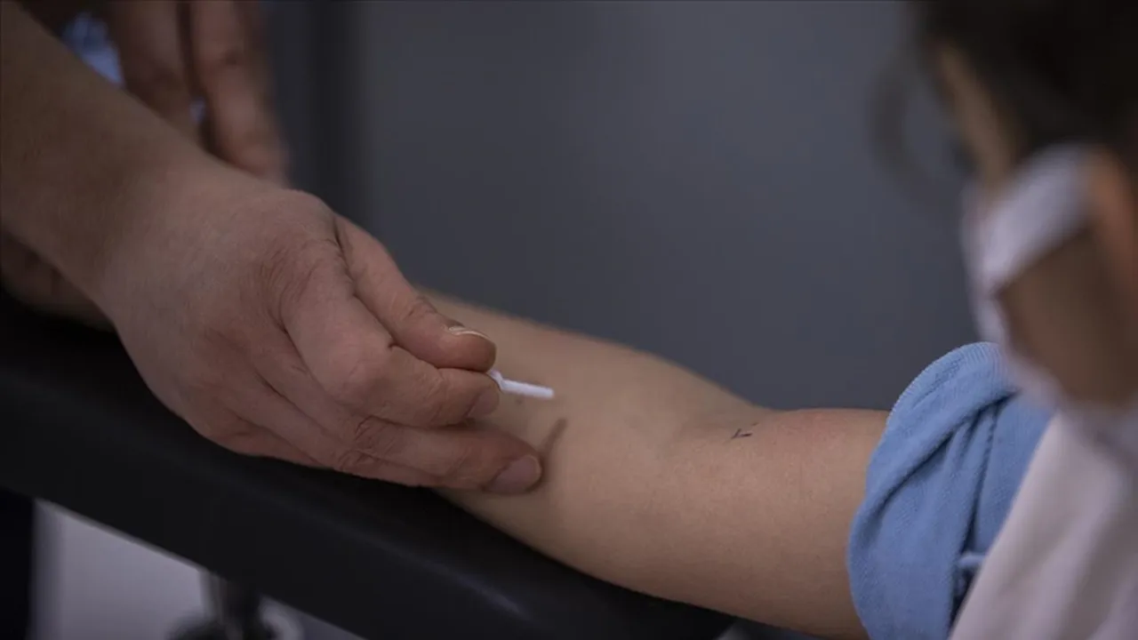 Her 20 çocuktan birinde görülüyor! İşte alerji riski olan 4 gıda