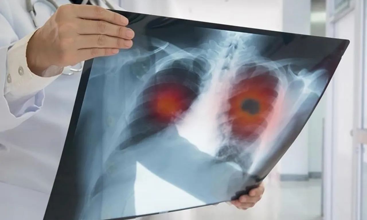 Evde kuş besleyenleri bekleyen tehlike! Akciğerleriniz tehdit altında olabilir