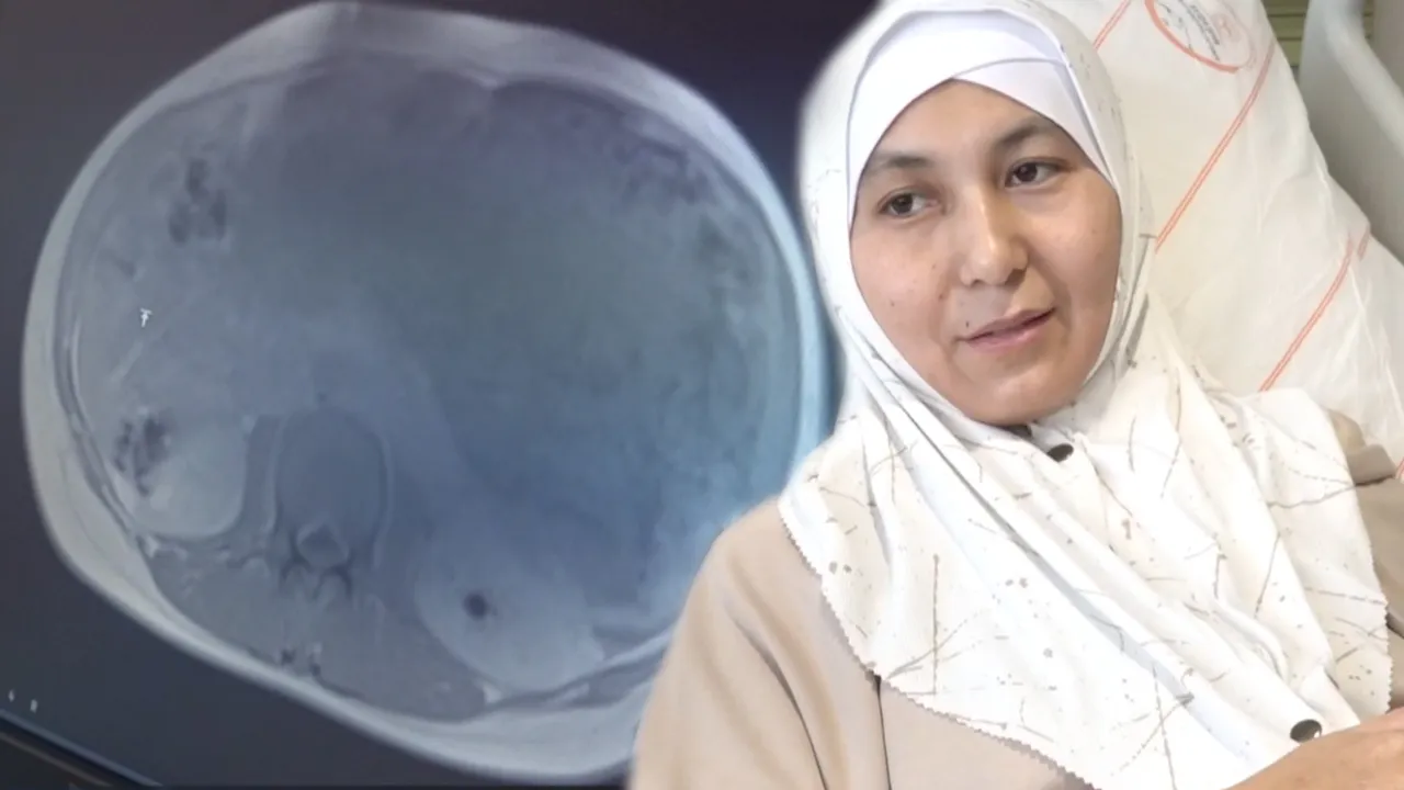 Midesinde sertlik fark etti! 6 çocuk annesi kadının karnından iki bebek büyüklüğünde kitle çıktı