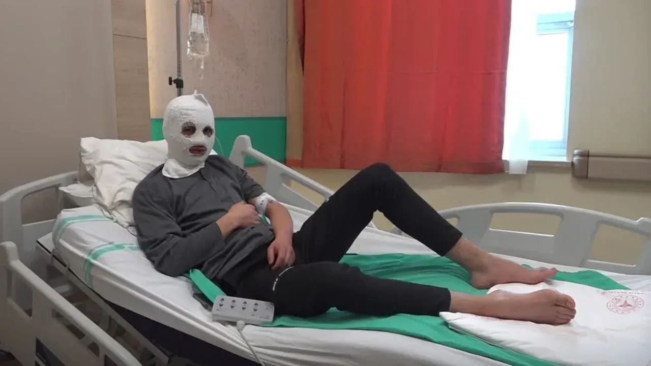 Gaz dolduran genç dehşeti yaşadı! Çakmak patladı, yüzü yandı 