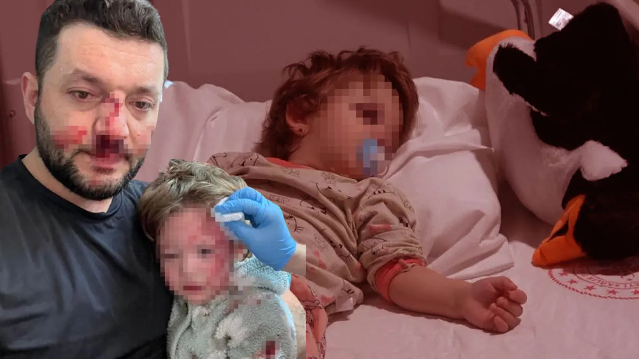 Yalova’da 14 aylık bebeği hastanelik ettiler! İçişleri Bakanlığı müfettiş görevlendirdi