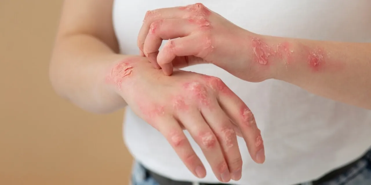 50 yaş ve üzeri risk altında! 3 kişiden birinde var: Sessizce ilerliyor