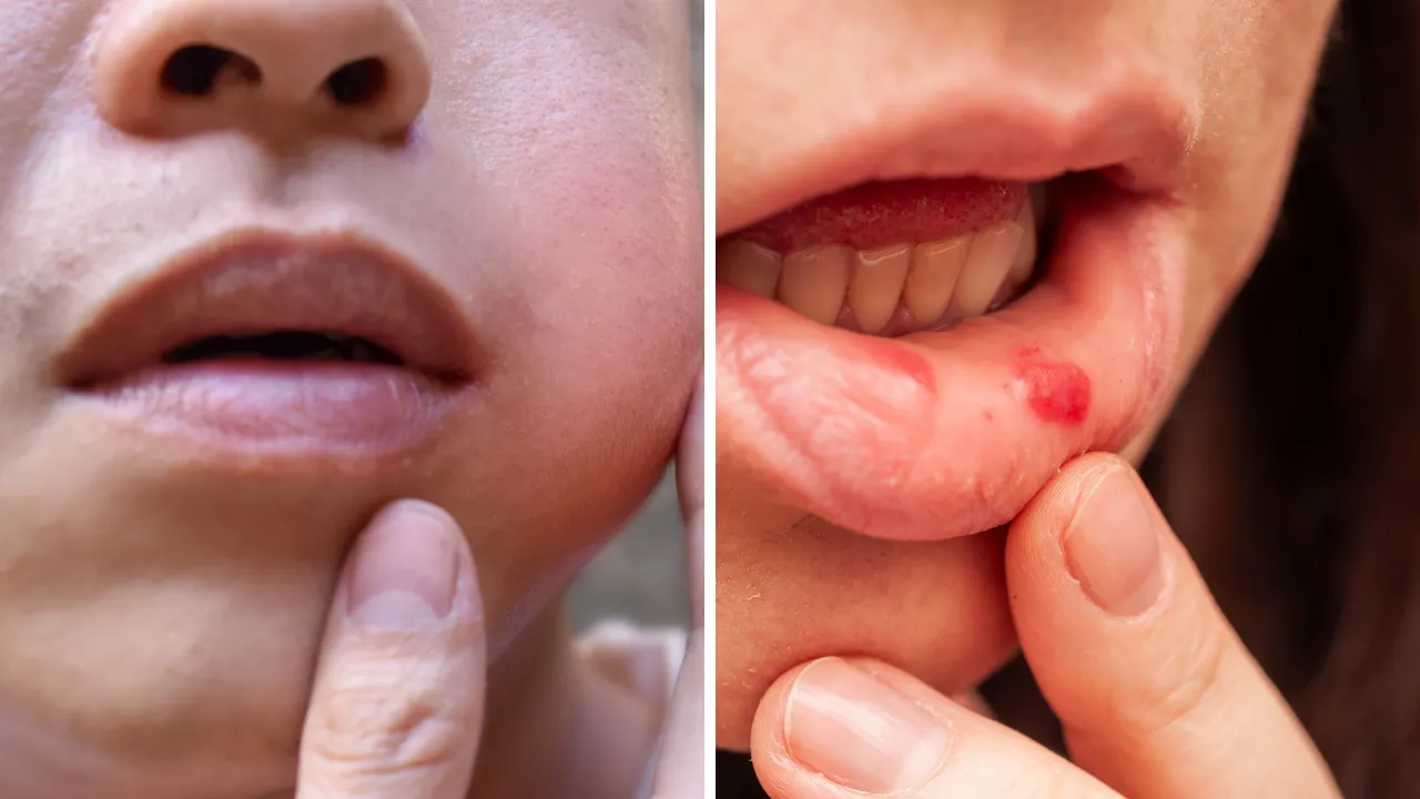 Ağzındaki yaraları yıllarca görmezden geldi, dili şişince öğrendi: Acı gerçek hastanede ortaya çıktı