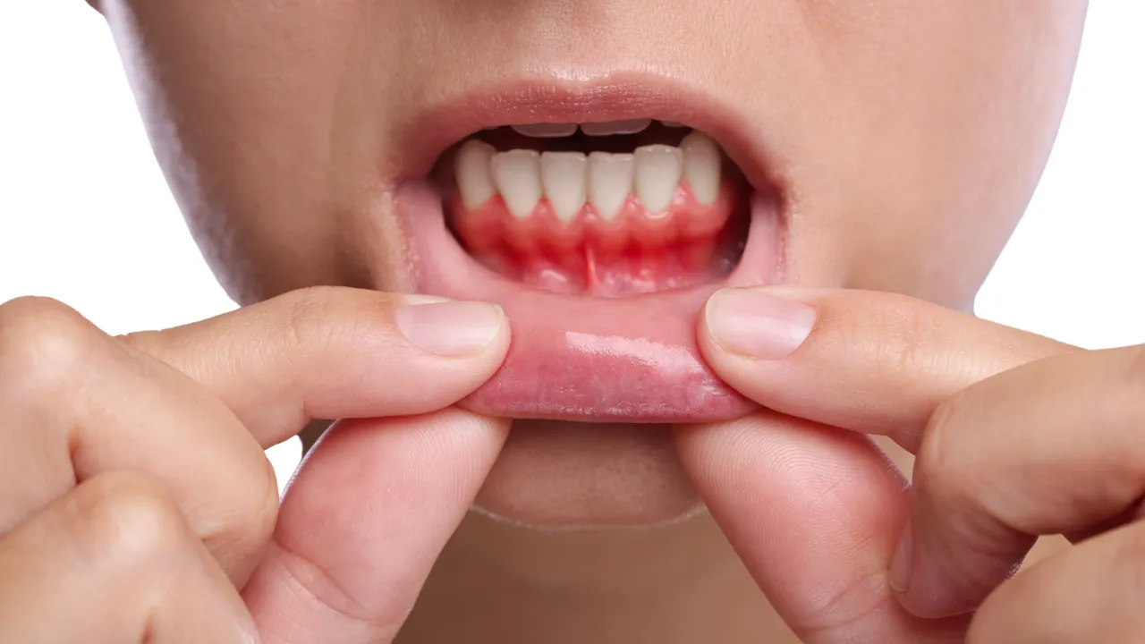 Ağzındaki yaraları yıllarca görmezden geldi, dili şişince öğrendi: Acı gerçek hastanede ortaya çıktı