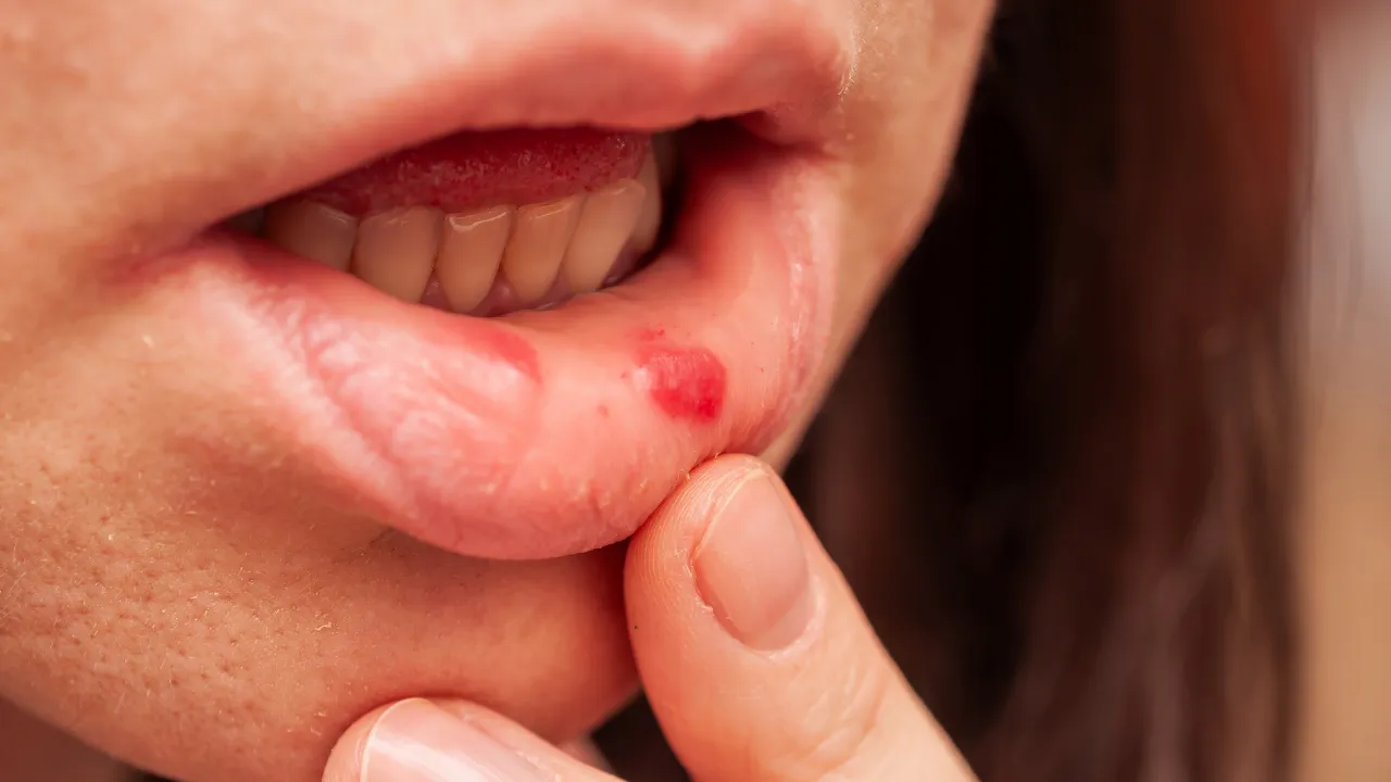 Ağzındaki yaraları yıllarca görmezden geldi, dili şişince öğrendi: Acı gerçek hastanede ortaya çıktı