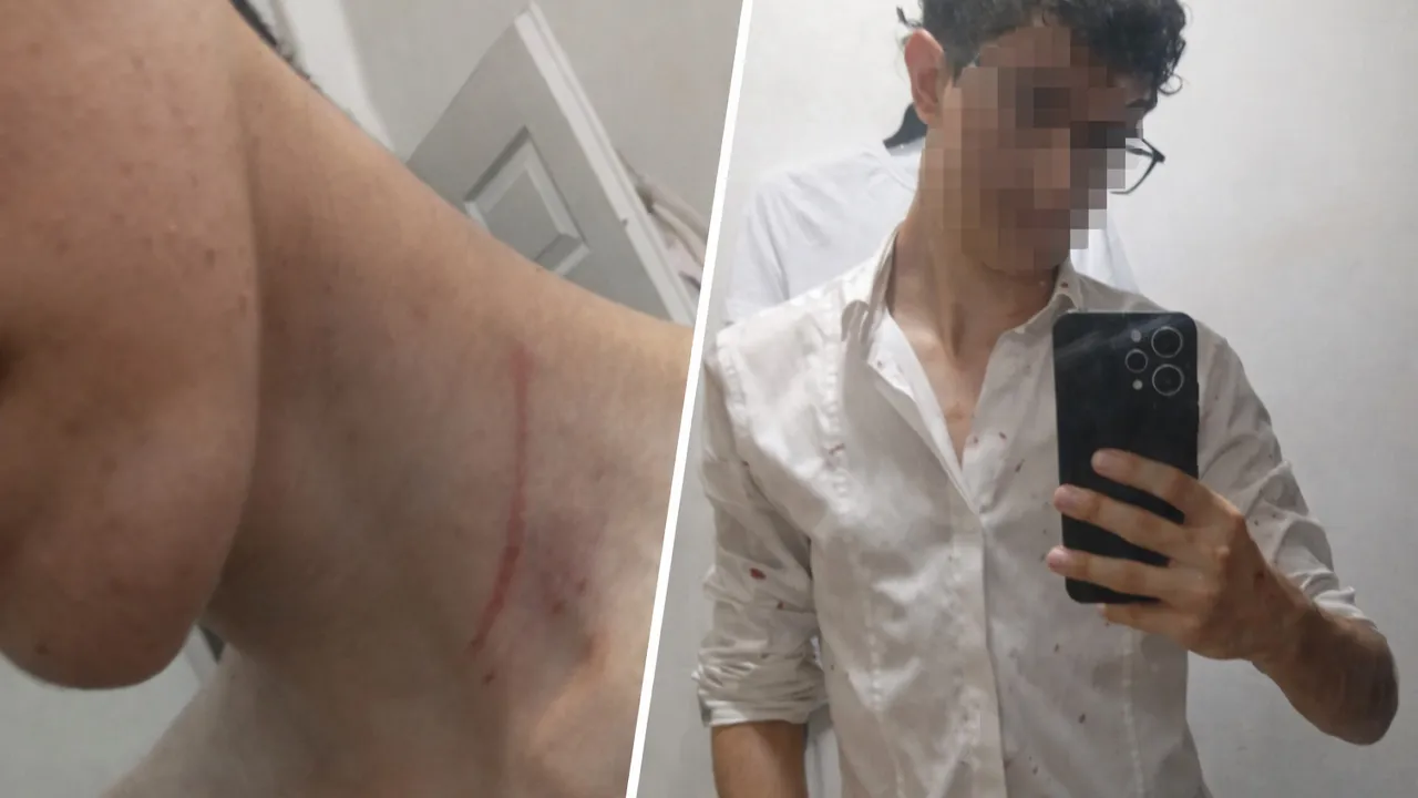 Okul dönüşü kabusu yaşadı:  Burnunu kırdıkları çocuğa yeni kıyafet alıp eve gönderdiler