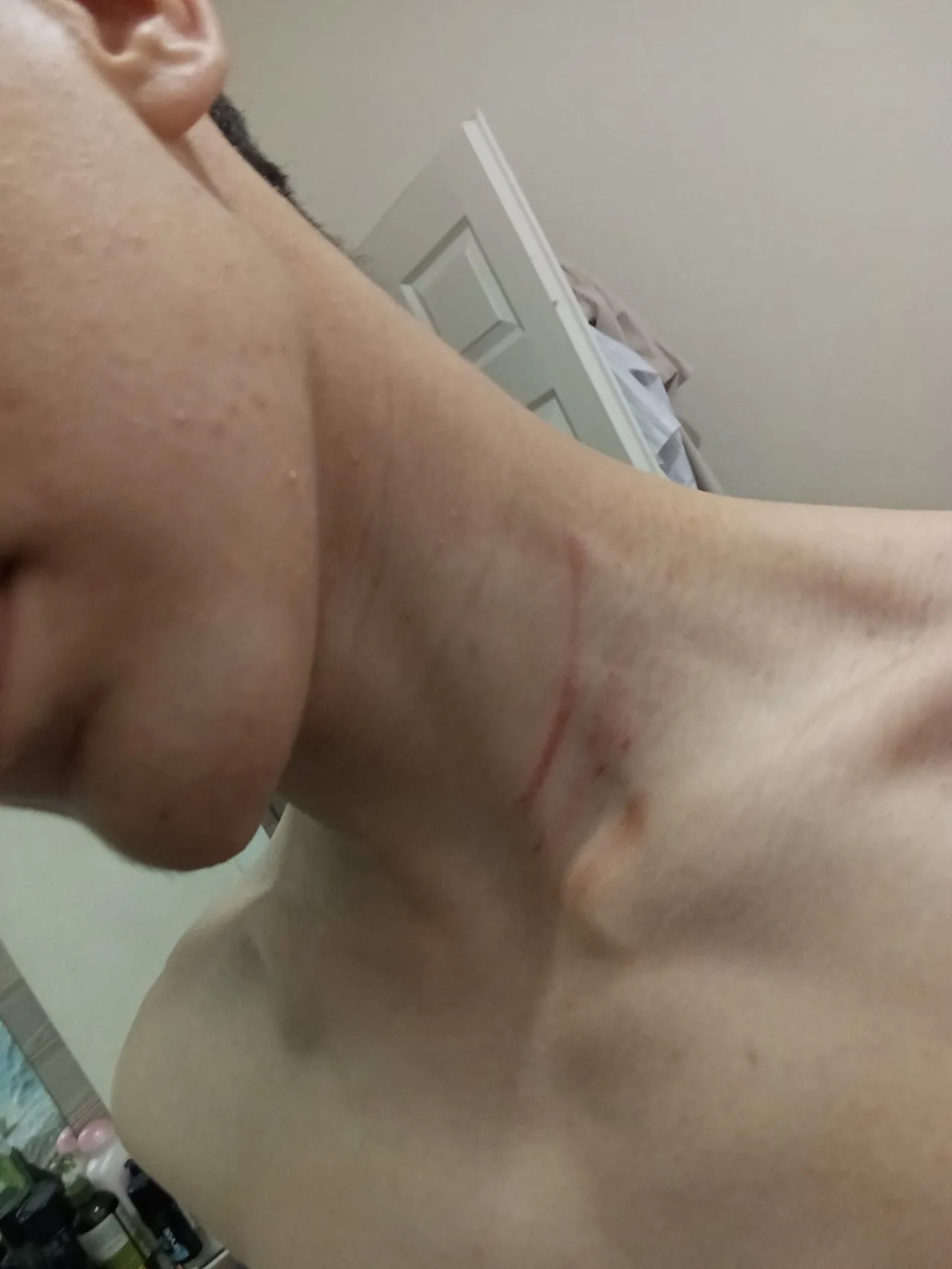 Okul dönüşü kabusu yaşadı:  Burnunu kırdıkları çocuğa yeni kıyafet alıp eve gönderdiler