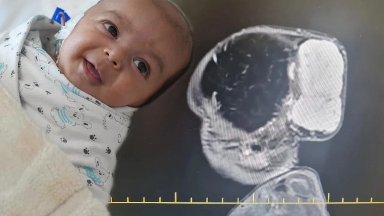 Minik Talha’ya büyük operasyon! Nadir görülen tümörle doğmuştu, hayata yeniden gülümsedi