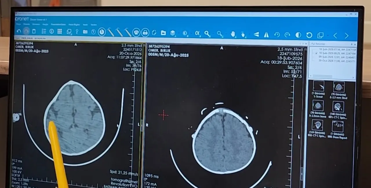 On binde bir görülen nadir hastalık! 5 aylık bebek ameliyatla sağlığına kavuştu