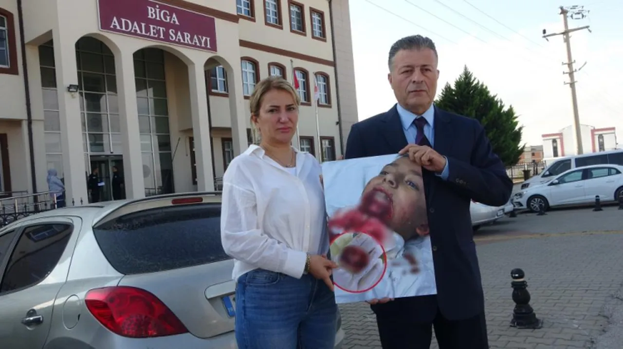 Okul bahçesinde çenesi demire saplanmıştı! İhmal davasında bilirkişi raporu çıktı