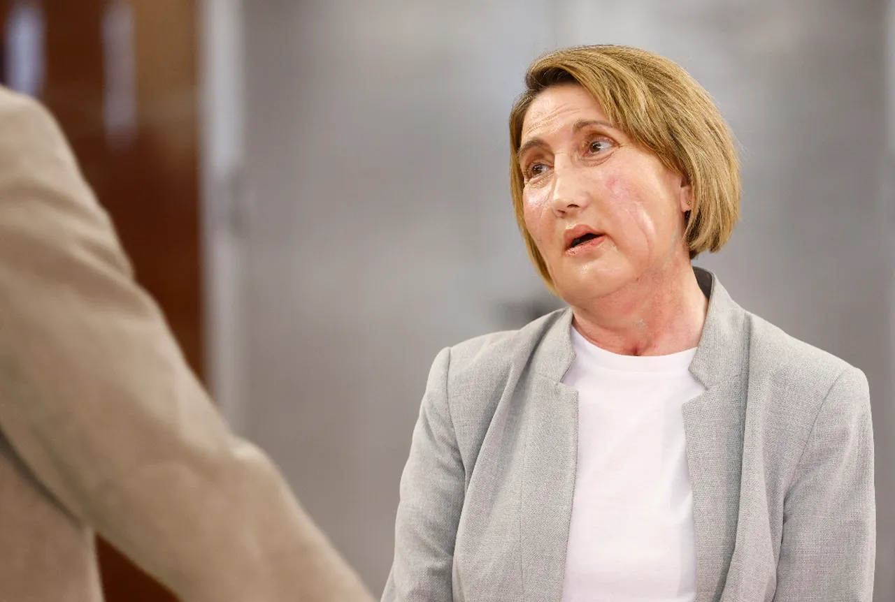 Virüsün yediği yüzüne organ nakliyle kavuştu