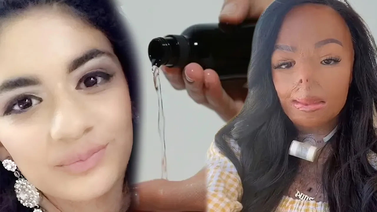 Bit şampuanı hayatını kararttı! Yüzü alevlerin arasında kaldı, parmaklarını kaybetti