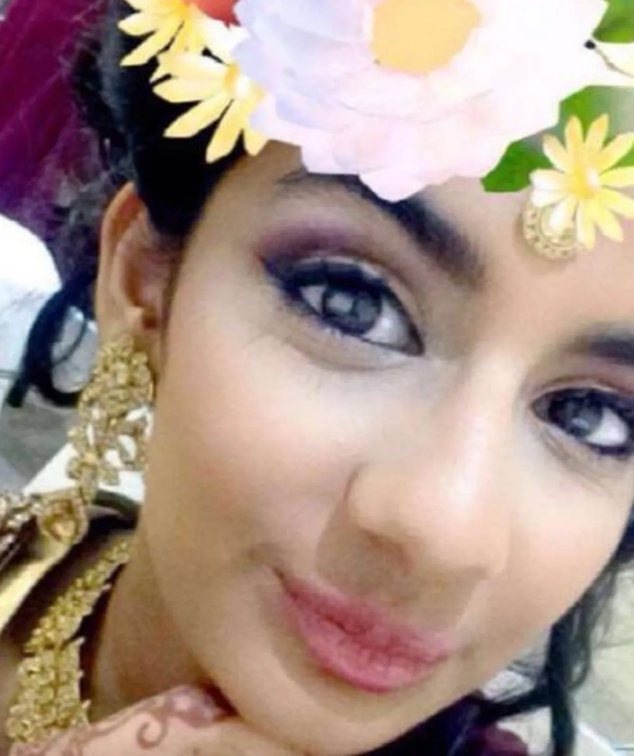 Bit şampuanı hayatını kararttı! Yüzü alevlerin arasında kaldı, parmaklarını kaybetti