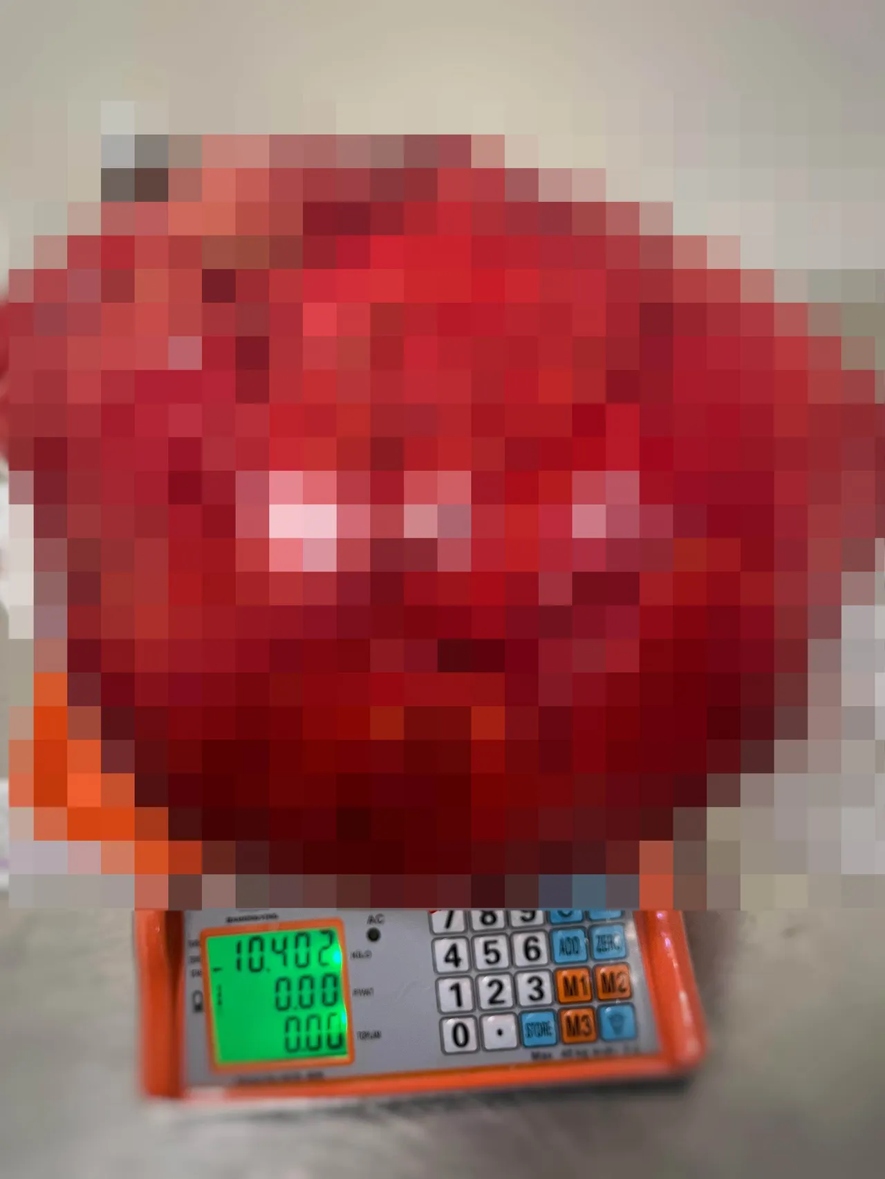 Kilo sandı hastanede hayatının şokunu yaşadı! Karnından 10,5 kiloluk kitle çıktı