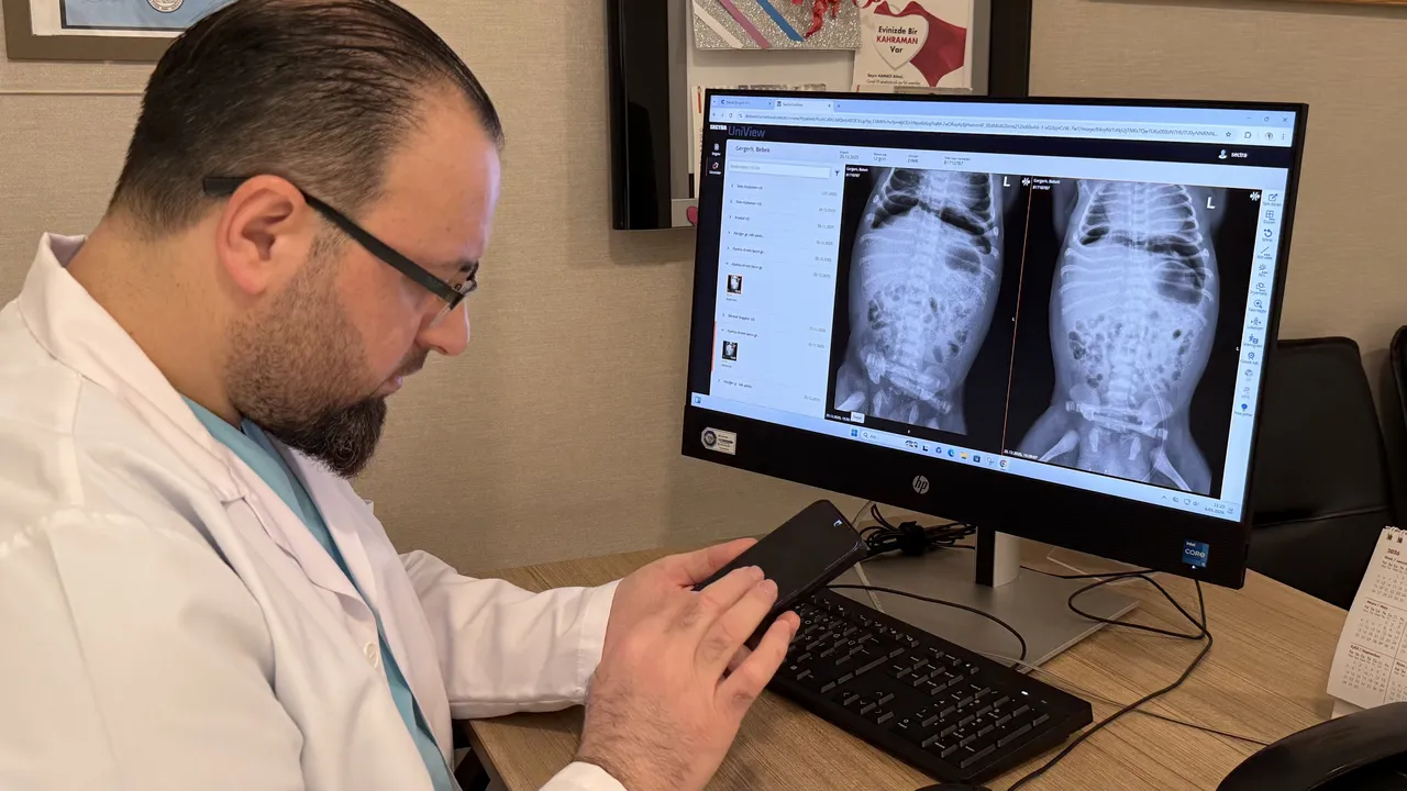 Çok nadir görülüyor! Anne karnında başladı, doğar doğmaz ameliyata alındı