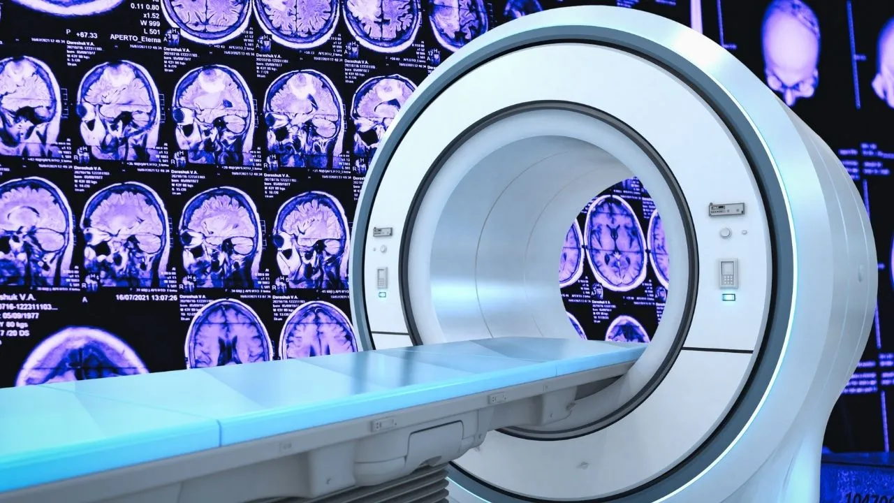 Sağlıkta yapay zeka kullanımı artıyor: Saniyeler içinde MR okuyup tanı koyuyor