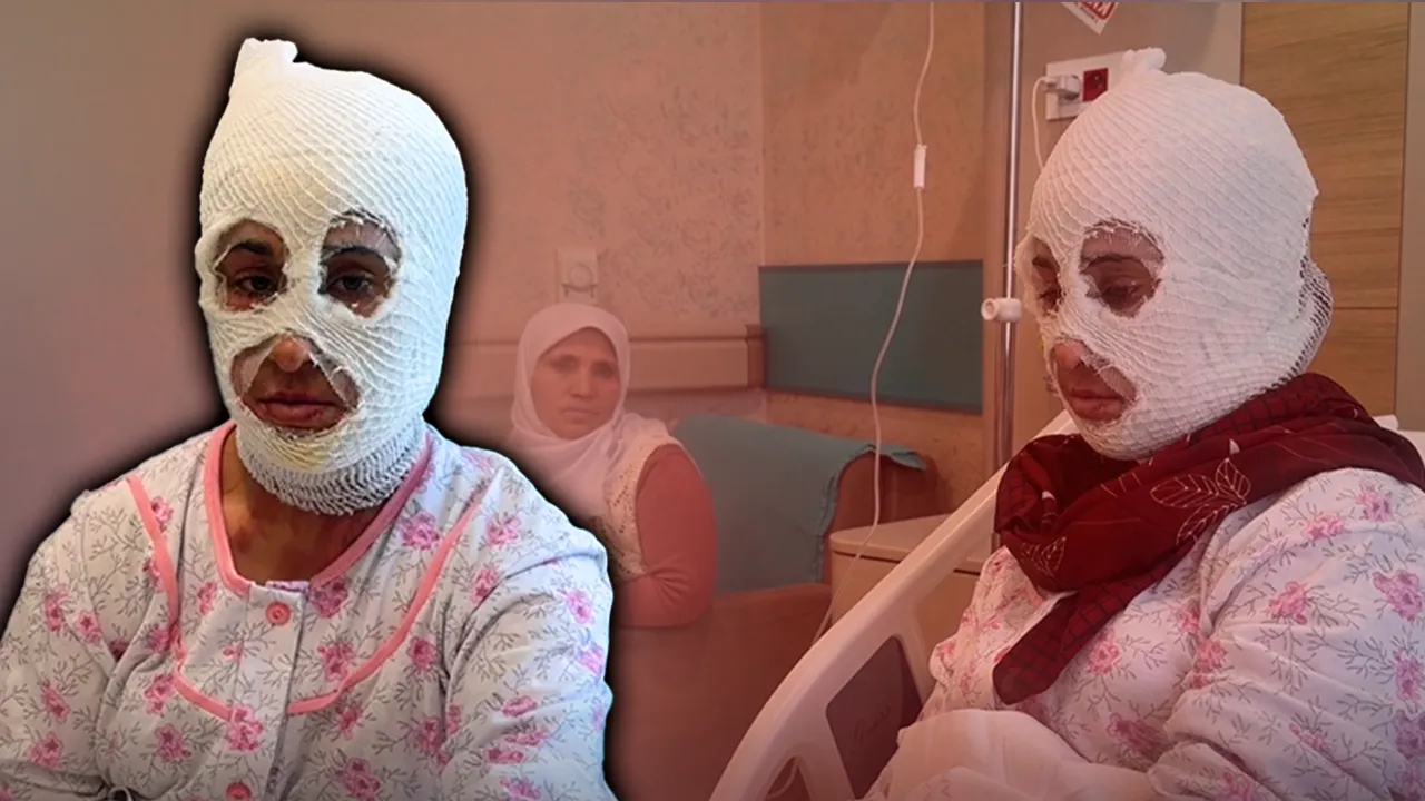 İftar öncesi dehşeti yaşadı: Yüzüme elimi sürdüğümde et parçası geliyordu