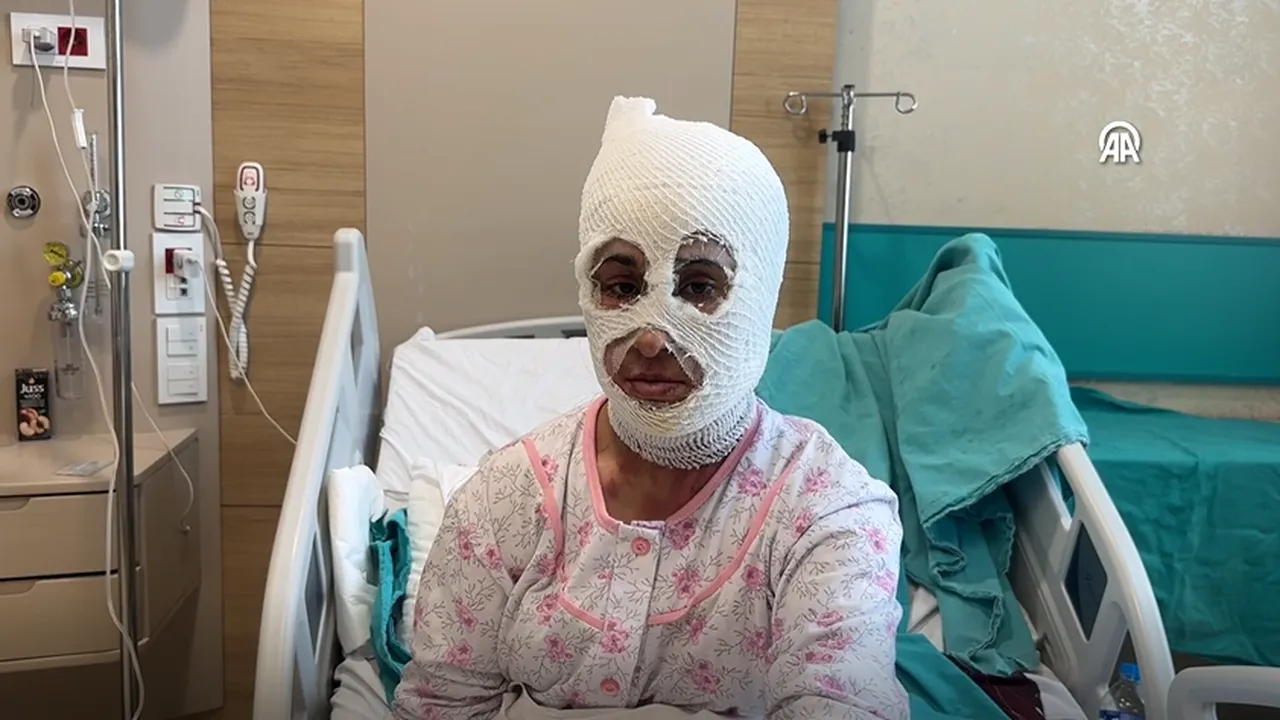 İftar öncesi dehşeti yaşadı: Yüzüme elimi sürdüğümde et parçası geliyordu