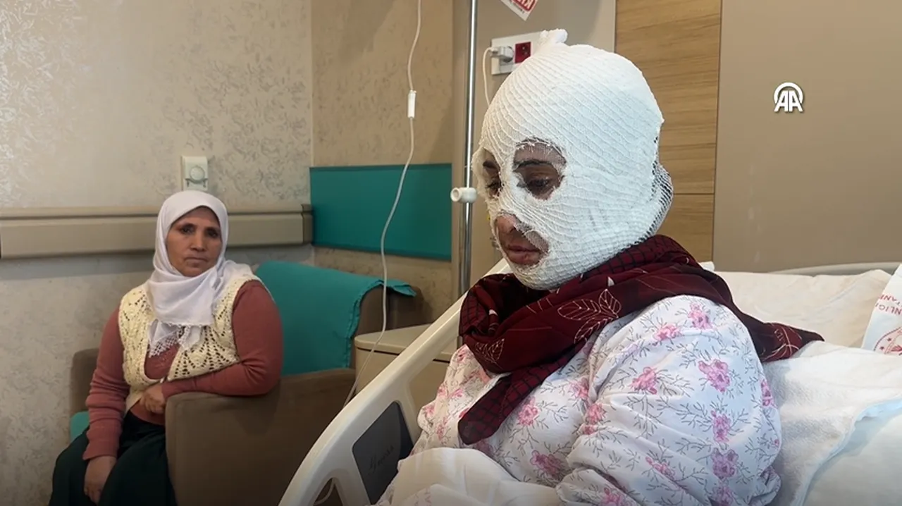 İftar öncesi dehşeti yaşadı: Yüzüme elimi sürdüğümde et parçası geliyordu