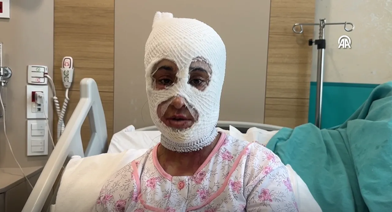 İftar öncesi dehşeti yaşadı: Yüzüme elimi sürdüğümde et parçası geliyordu