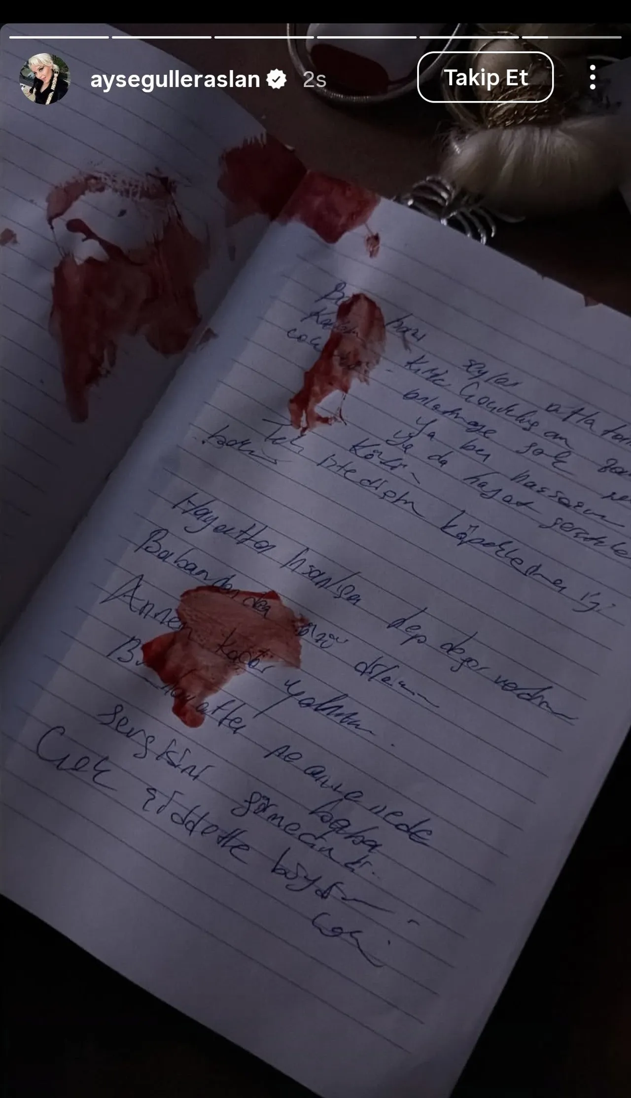 Ayşegül Eraslan intihar mı etti? İşte Benim Stilim ile adını duyurmuştu, kanlı paylaşım yaptı