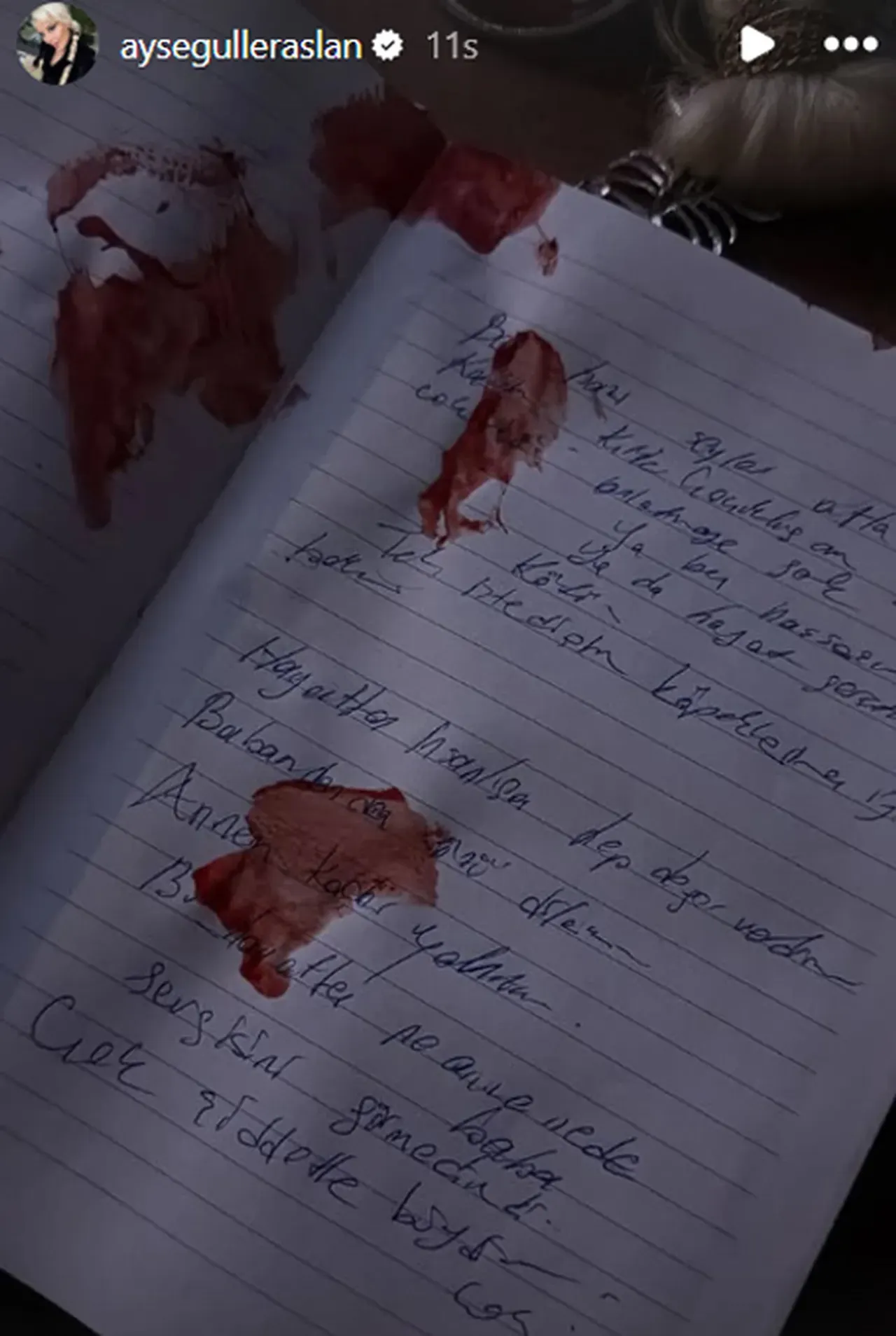 İntihar değil cinayet! Ayşegül Eraslan'ın otopsi raporundaki gerçek ortaya çıktı