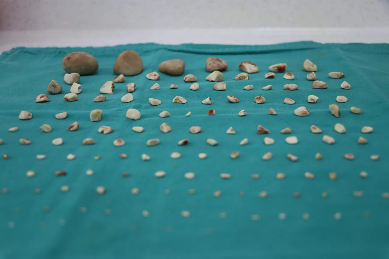 Görenler inanamadı! Köpeğin karnından 140 taş çıkarıldı