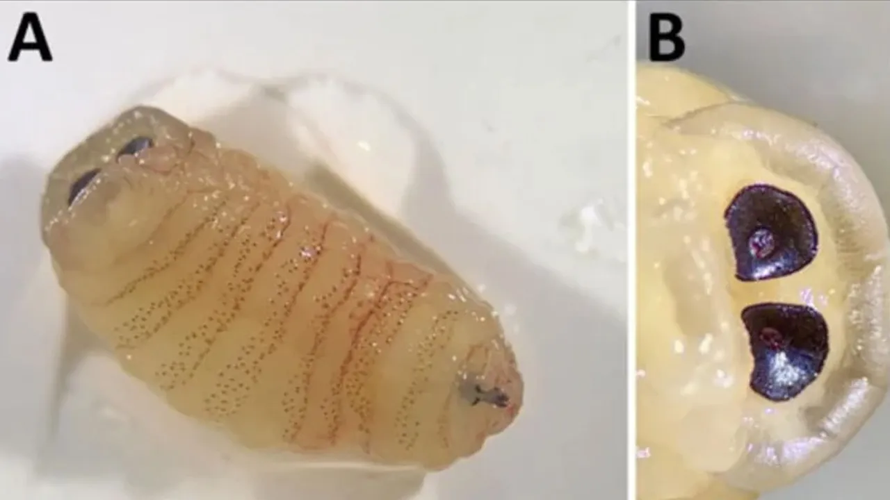 Öksürük nöbeti geçiriyordu! Hapşırdığında ise burnundan kurtçuklar fırladı