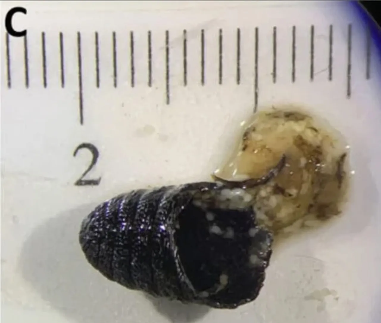 Öksürük nöbeti geçiriyordu! Hapşırdığında ise burnundan kurtçuklar fırladı